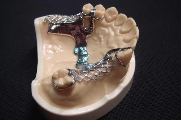 三、镶牙上牙13颗下牙14颗正常吗｜处理步骤