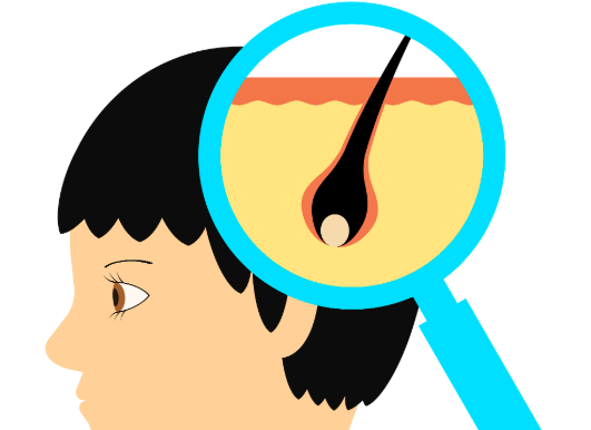 二、植发两个月感觉都秃了：可能影响脱落的非手术因素