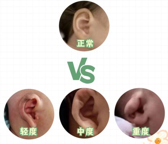 九、韩国波轮美整形医院