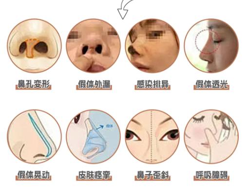 三、鼻修复医生技术解析与服务特色