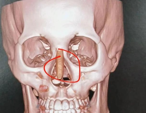 二、国内鼻修复优质机构及医生详情