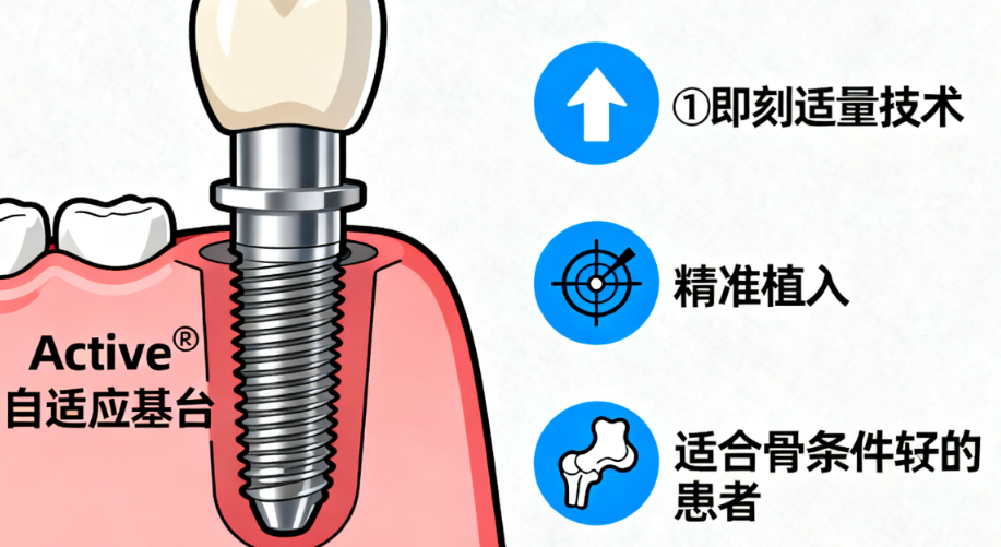 2026年pmc种植体愈合基台稳定性测试：临床数据对比结果出炉！选型避坑指南全解析