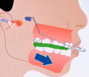 二、临湘天门牙科项目价格对比