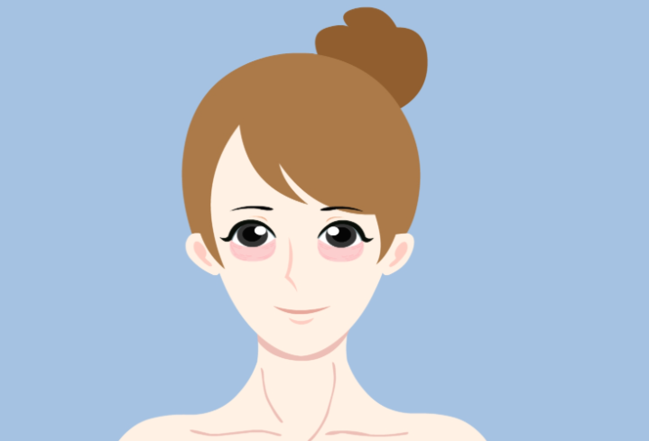 adm卧蚕手术可以维持多久？2026年数据揭秘维持时间+术后恢复期