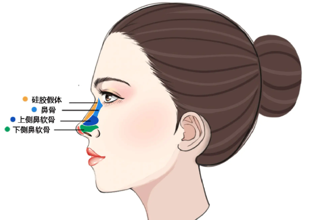 七、韩嘉毅鼻子实例真实避坑指南:拒绝网红同款选妈生鼻