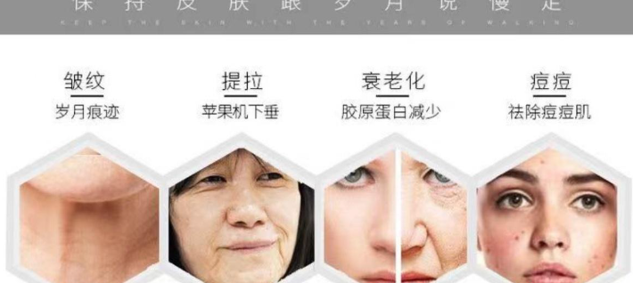 做完7d三个月感觉脸更松了？真实测评：恢复期松垮是正常现象但3个月后需警惕这些细节