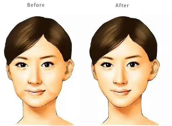 二、双逆博士面部抗衰的实际疗效与适用人群