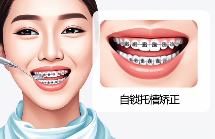 四、金属自锁托槽的使用建议与护理技巧