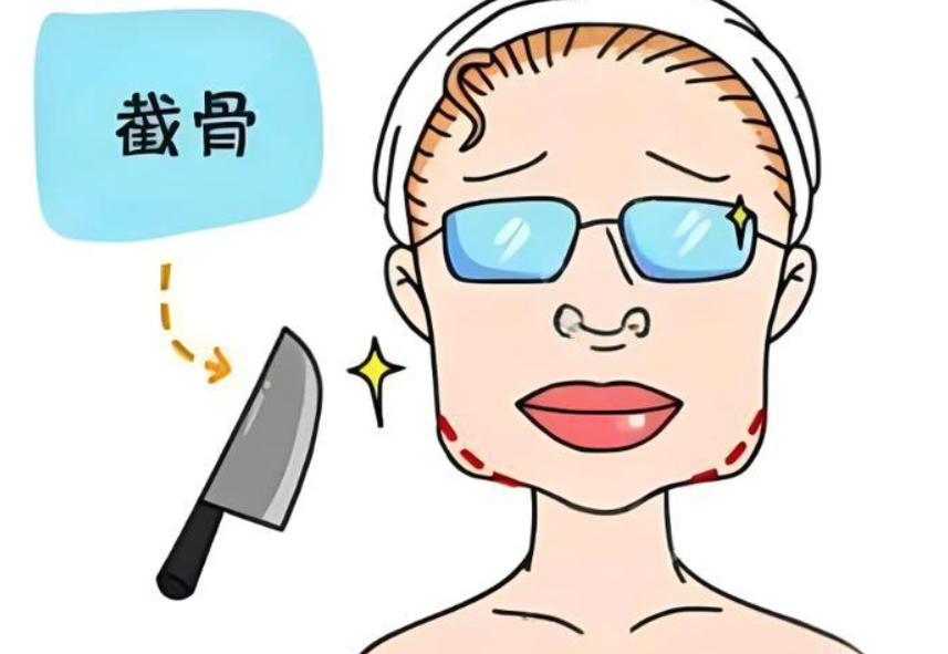 下巴打过葡聚糖后下颚有点疼正常吗？7天内冰敷消肿是关键！