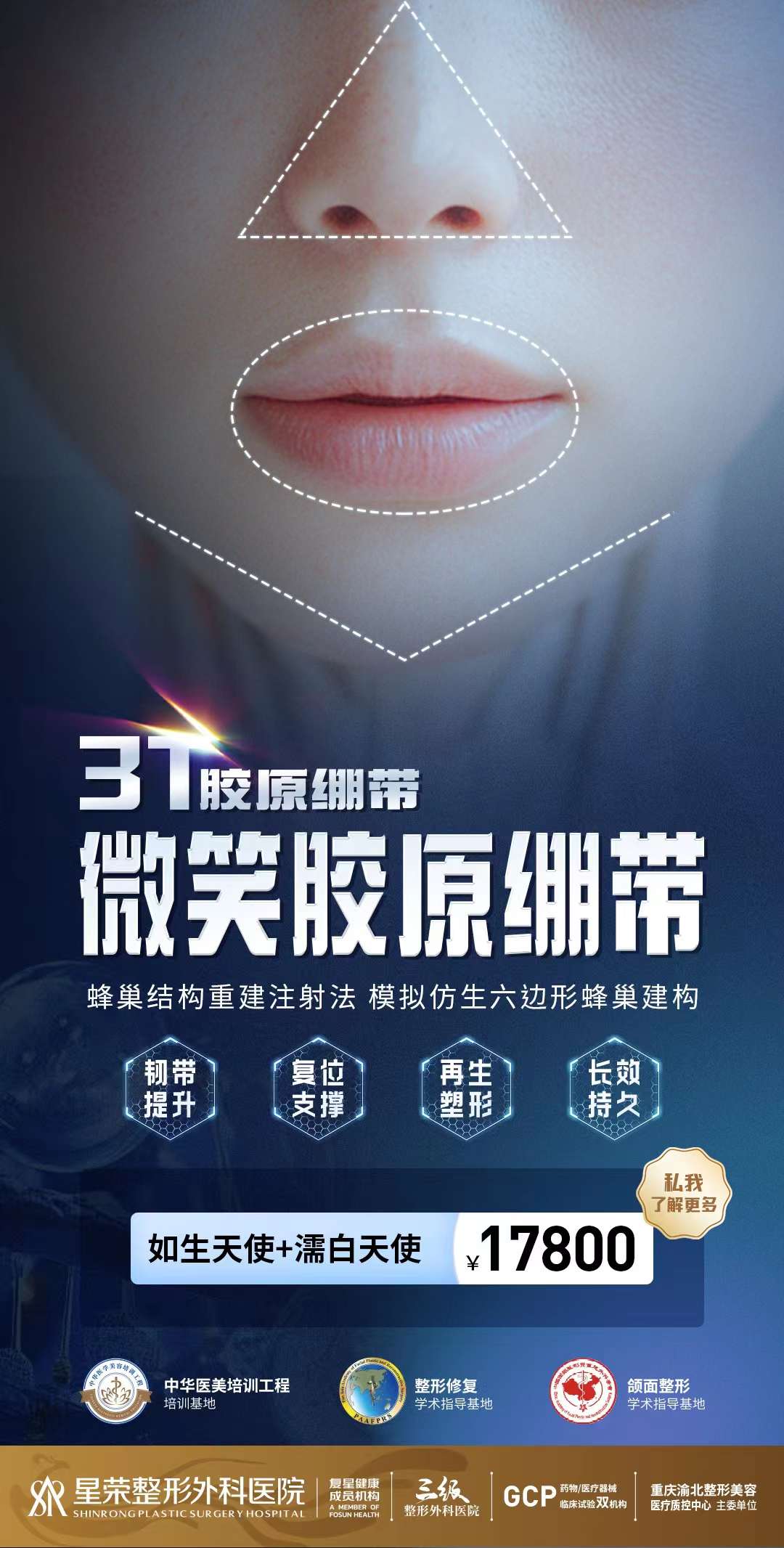 重庆星荣整形吕巍抽脂