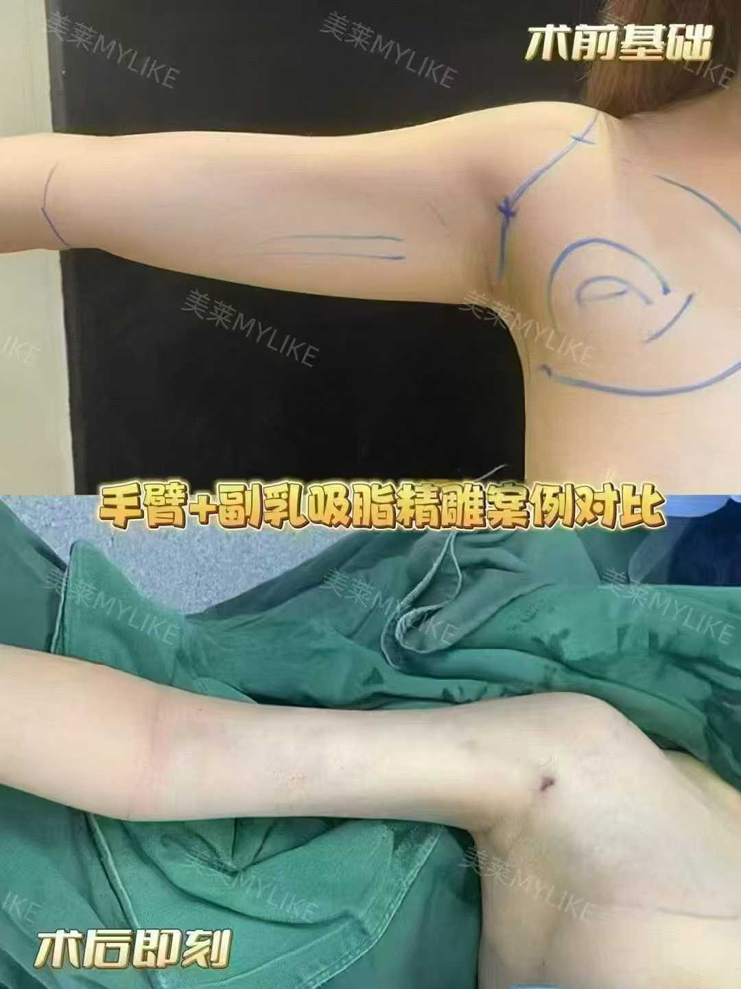 六、石家庄美莱口腔中心