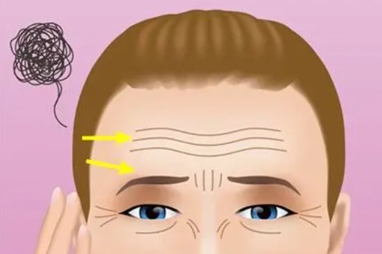 二、广州陈兵拉皮怎么样:技术口碑与用户评价深度解析