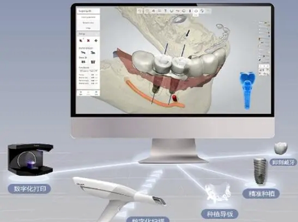二、3D建模与数字化技术如何实现稳准牵引
