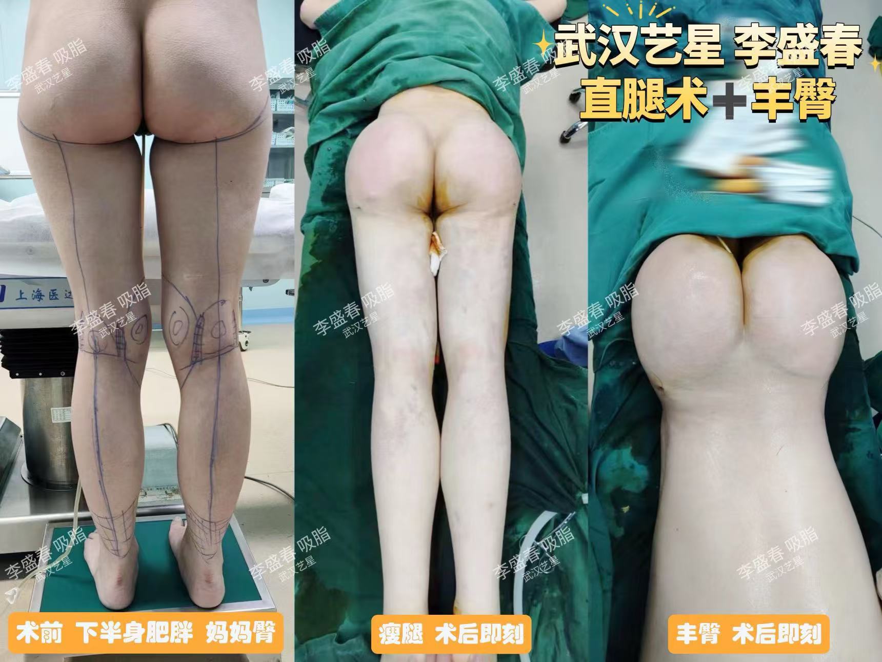 五、武汉艺星整形医院与同类机构对比：选择依据与差异化优势