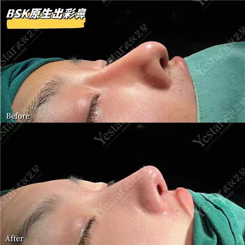 三、武汉艺星整形医院医生团队实力：医生级配置与技术特色