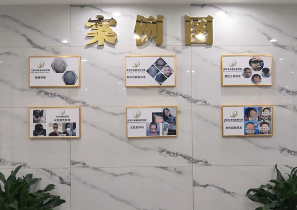 三、沈阳华美疤痕医院