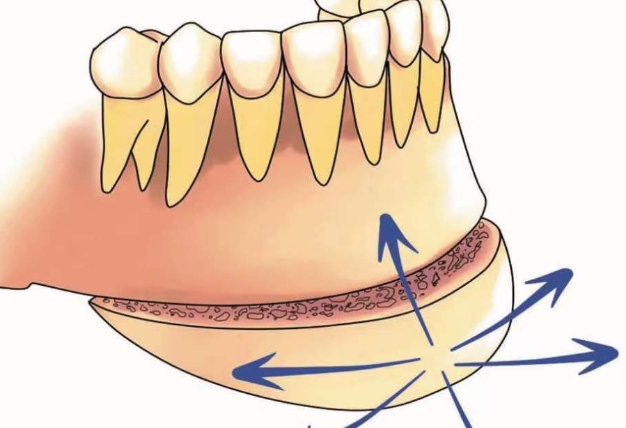 三、整形项目选择与注意事项