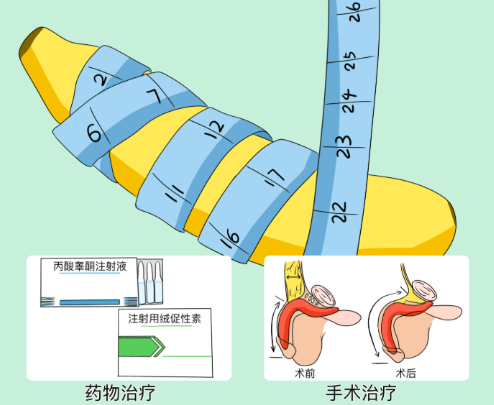 五、李世荣男科整形适用人群及术后注意事项