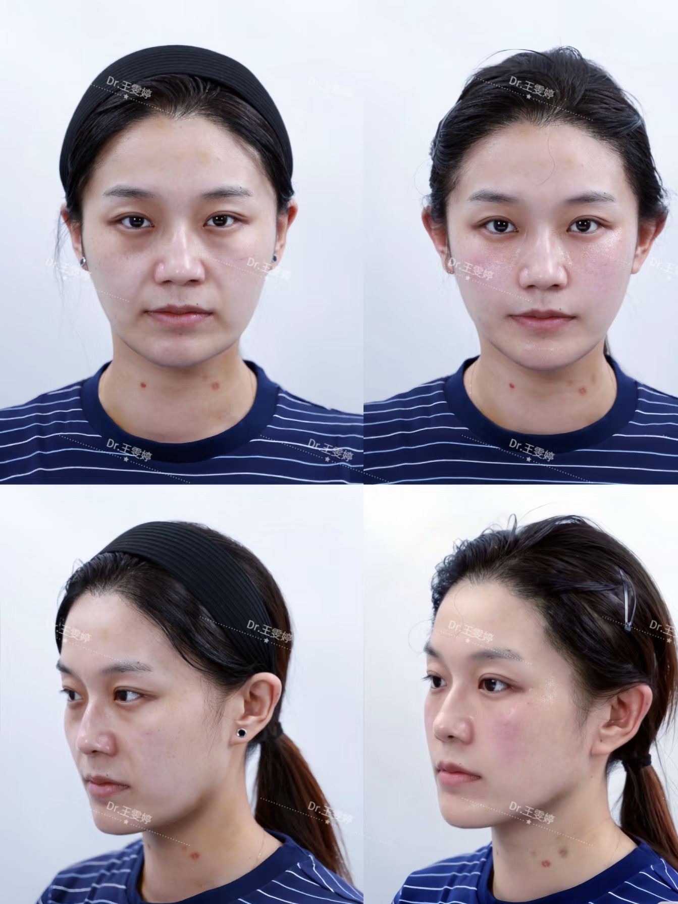 三、广州艺星整形