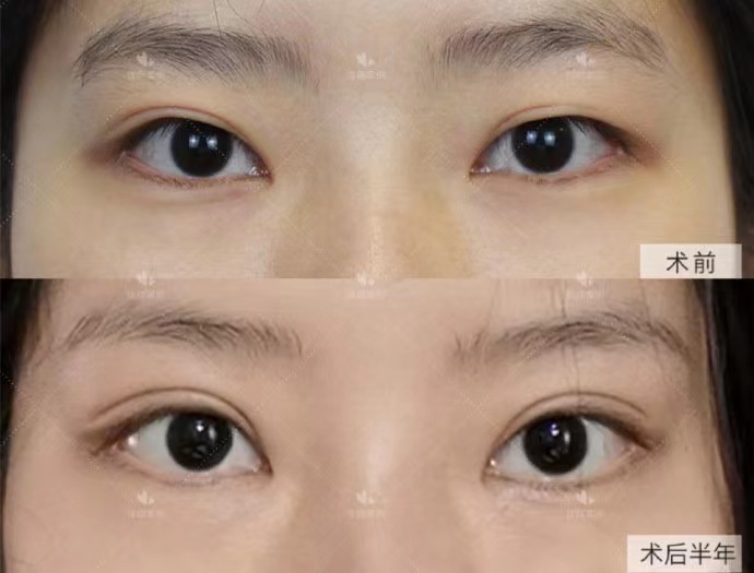 六、广州可玉整形