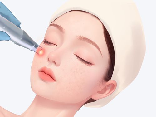 小拉皮切口鼓包能下去吗？专业解答：90%患者3个月内完全消退！