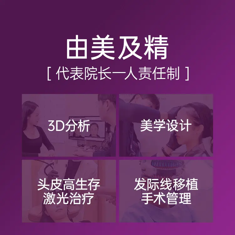 女性切開式植髮 療程示意