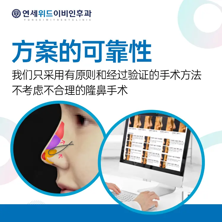 隆鼻修復 療程示意